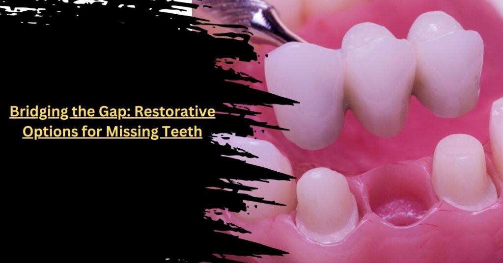 Bridging the Gap Restorative Options for Missing Teeth
